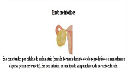 Endometrióticos