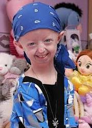 progeria